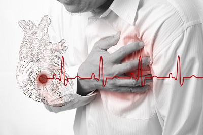 רשלנות רפואית באבחון התקף לב